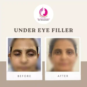 drneha-dermatologist-clients-treatment-photos (4)