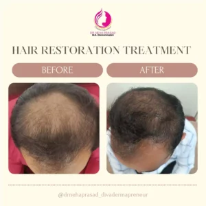 drneha-dermatologist-clients-treatment-photos (5)