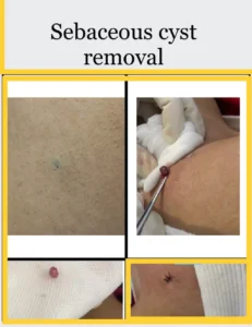 img-20240313-wa0040-65f8133993bd3